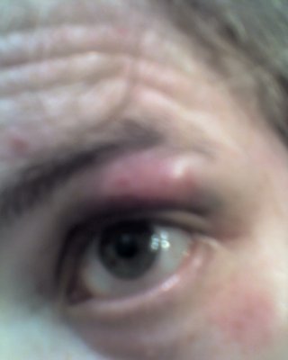 eye2.jpg