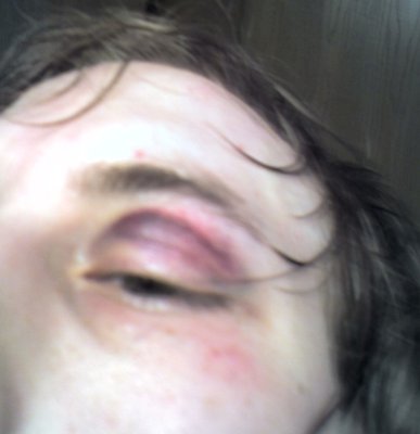 eye3.jpg
